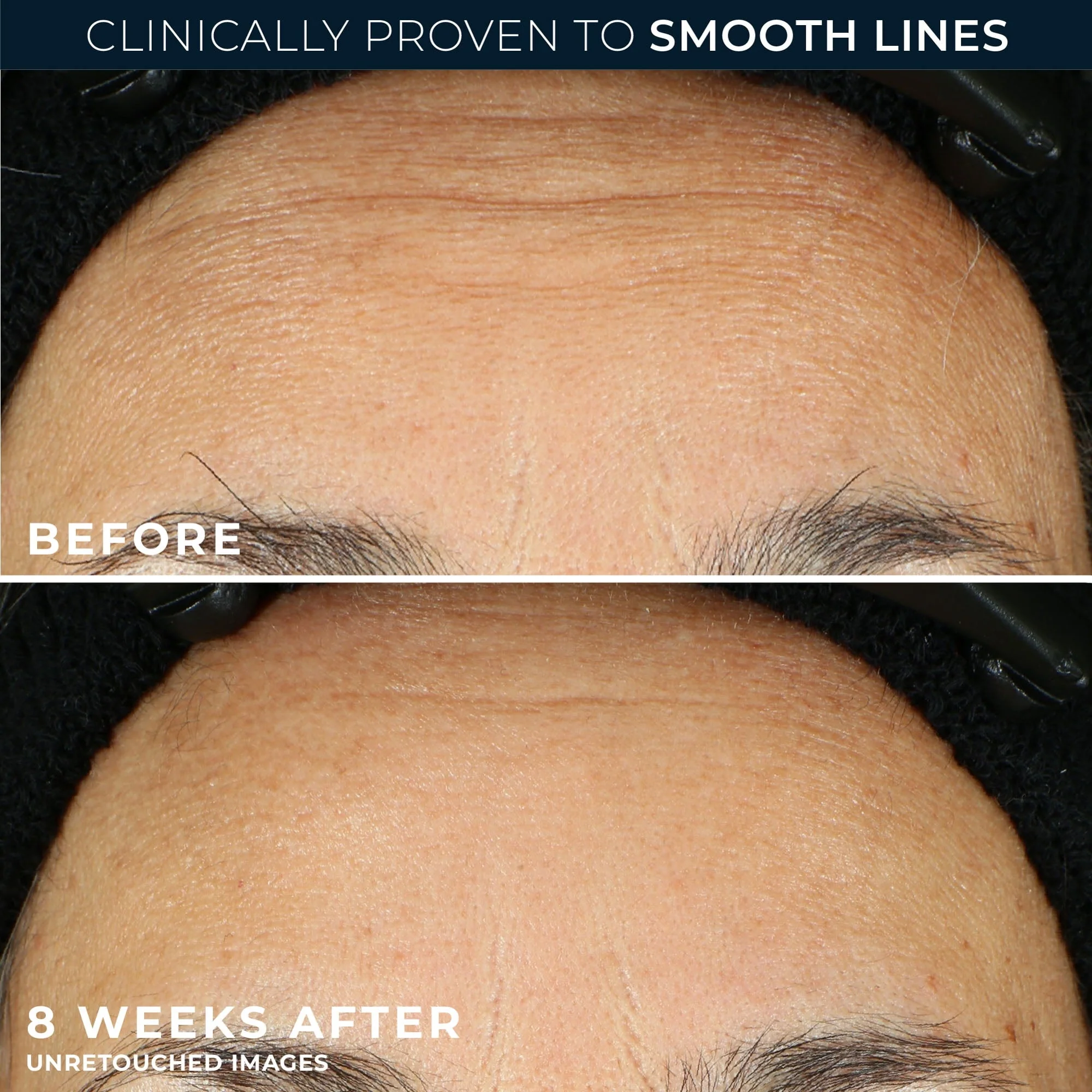 RoC Retinol Correxion Capsules, Anti-Aging Night Serum, Anti-Wrinkle Treatment, 30 Ct - Image 4