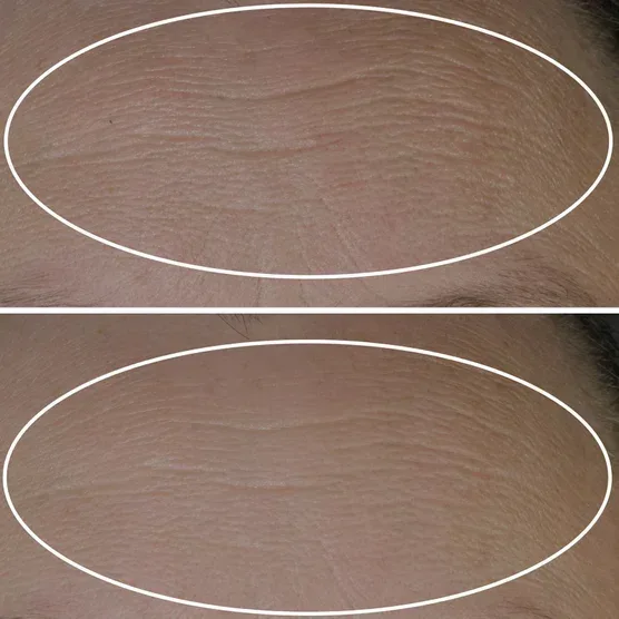 StriVectin Peptide Plump Line Filling Bounce Serum, 1.0 fl oz + 0.5 fl oz - Image 2