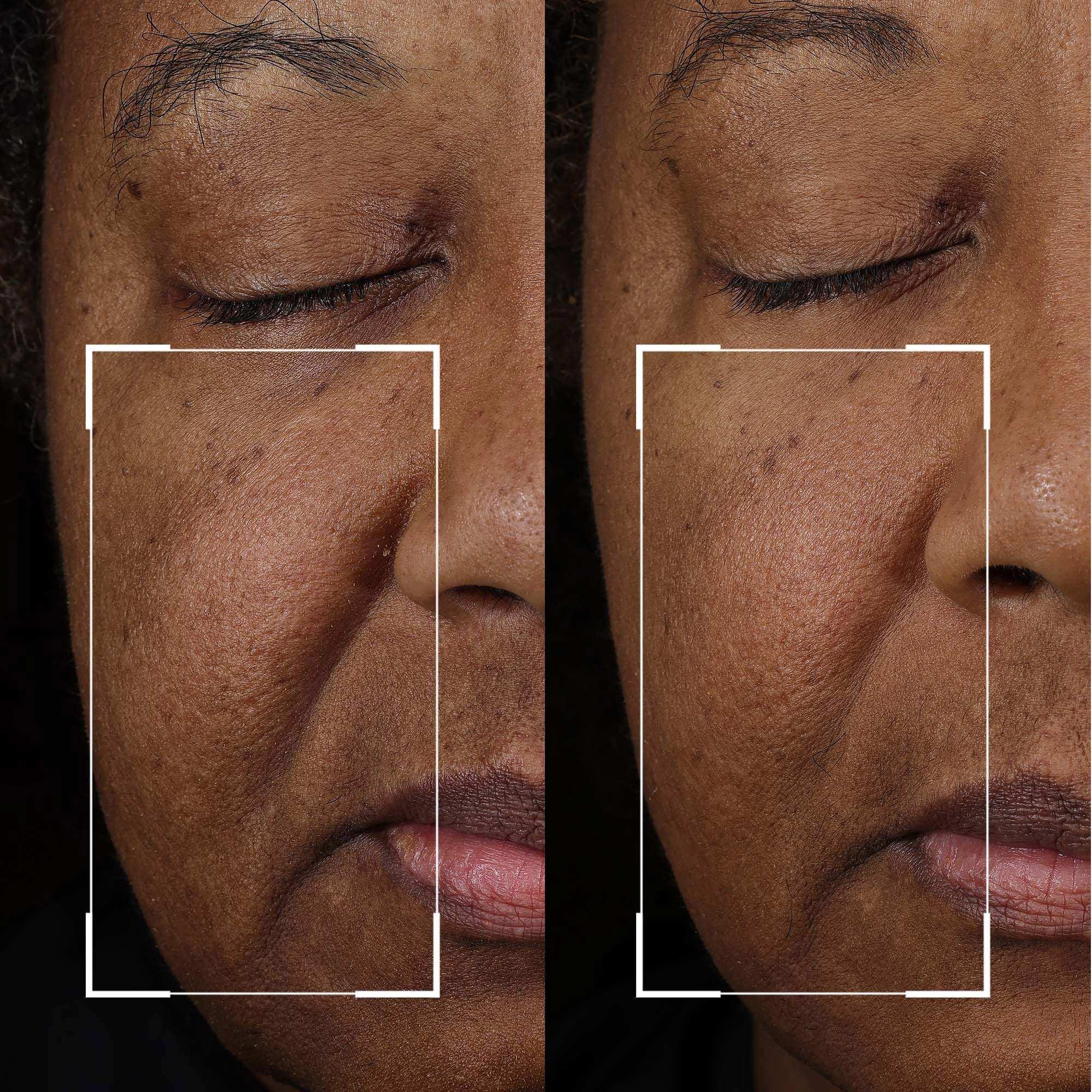 Strivectin Peptight Face Lift Serum - Image 2