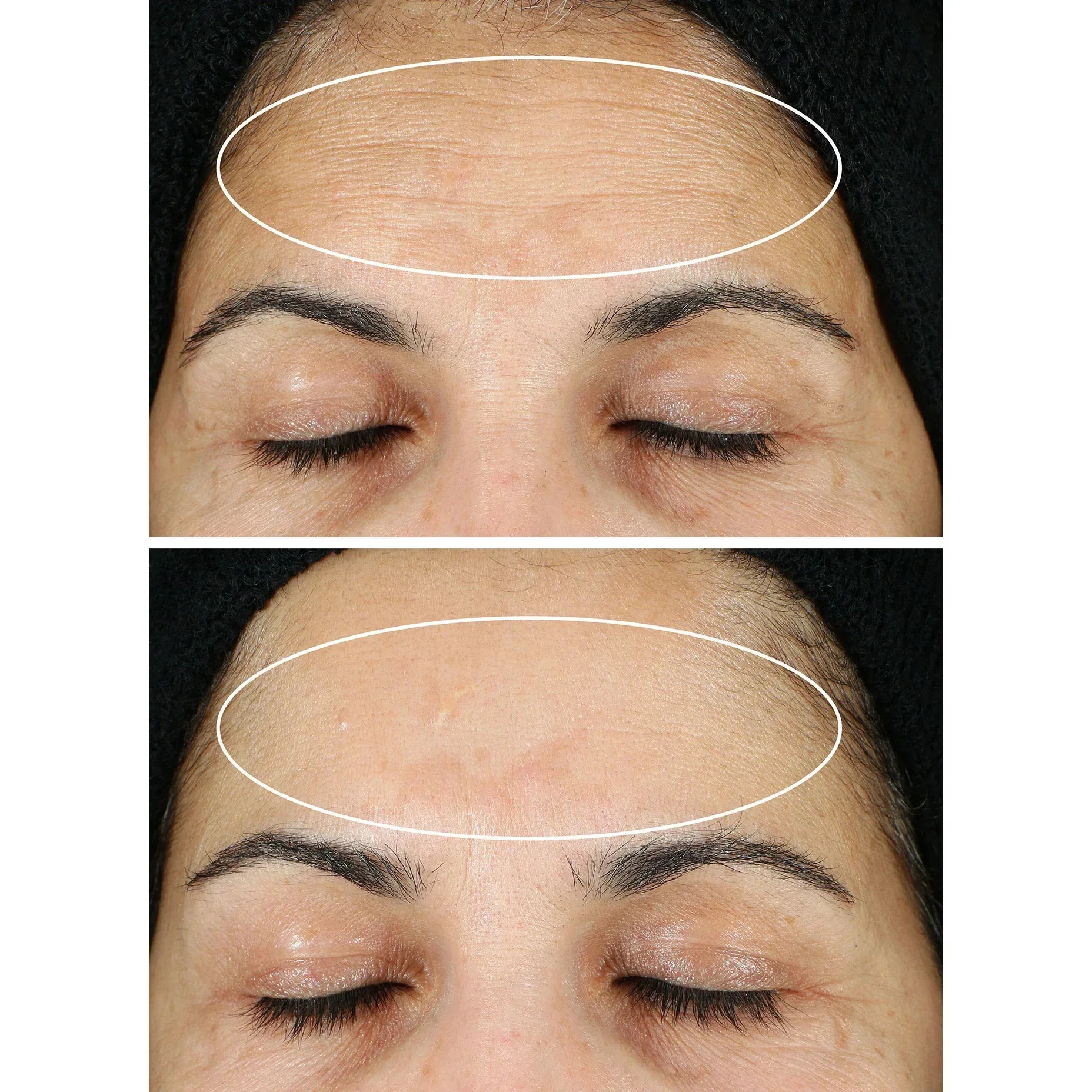 StriVectin Super C Retinol Serum, 1.0 fl oz + 0.5 fl oz - Image 3
